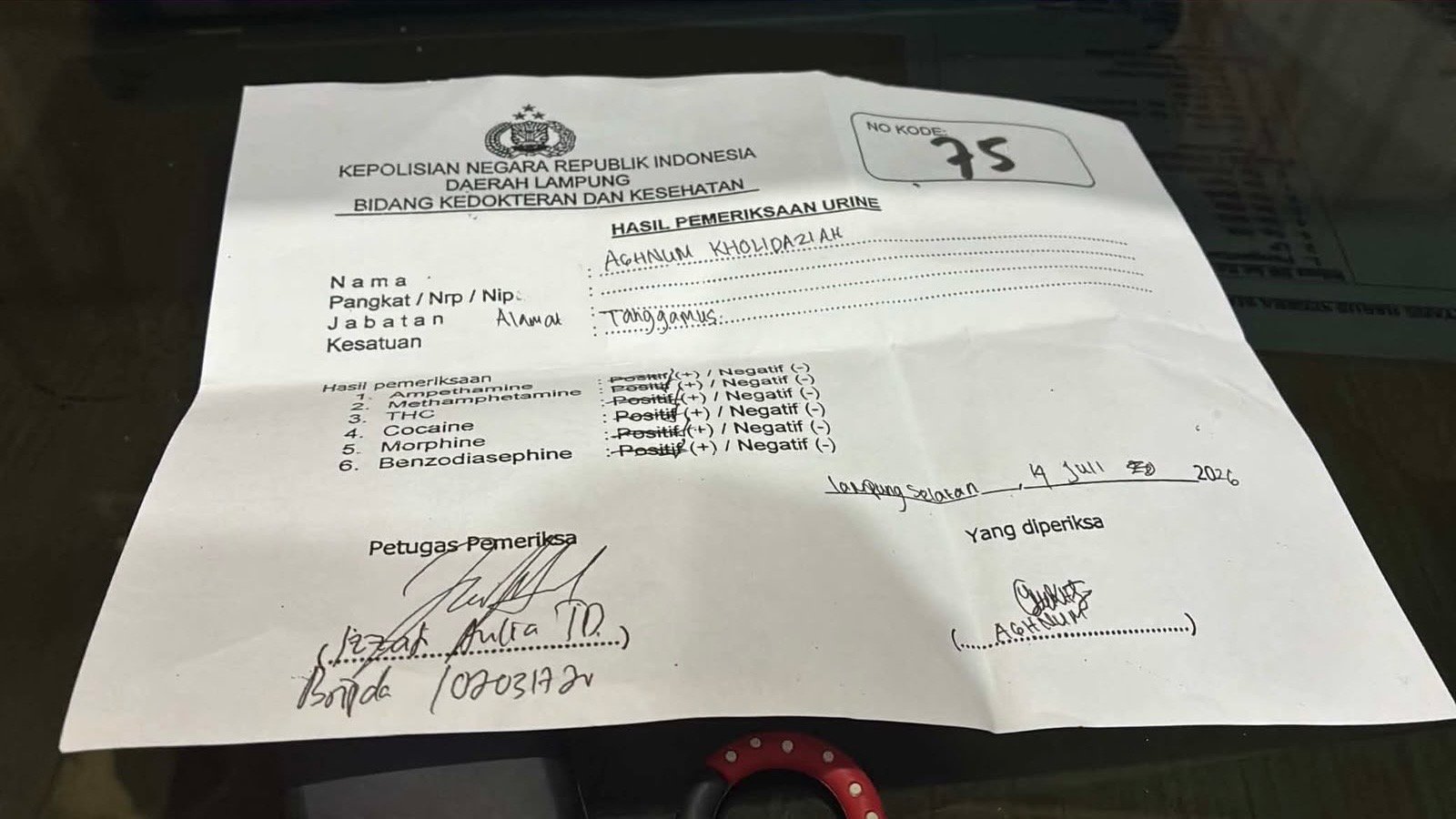 Hasil pemeriksaan tes urin yang ditunjukkan kepada media